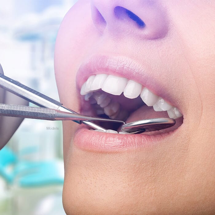 What Kind of Sedation Do Dentists Use? - Afshin Salamati, DDS, MS