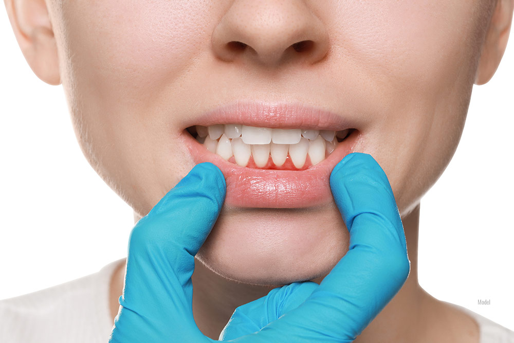 close-up of woman's teeth shows gum